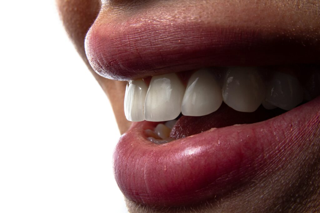 Digital smile Design