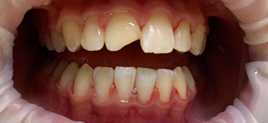 Антистрессовое лечение