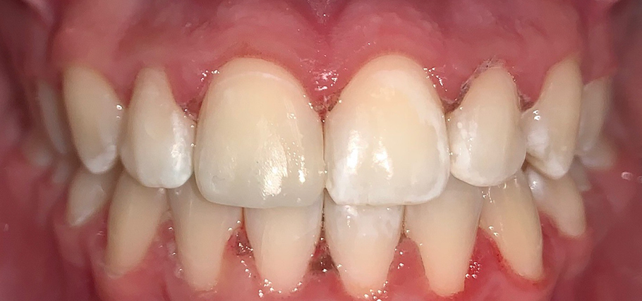 Антистрессовое лечение