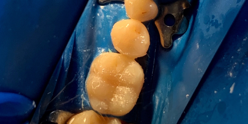 Антистрессовое лечение