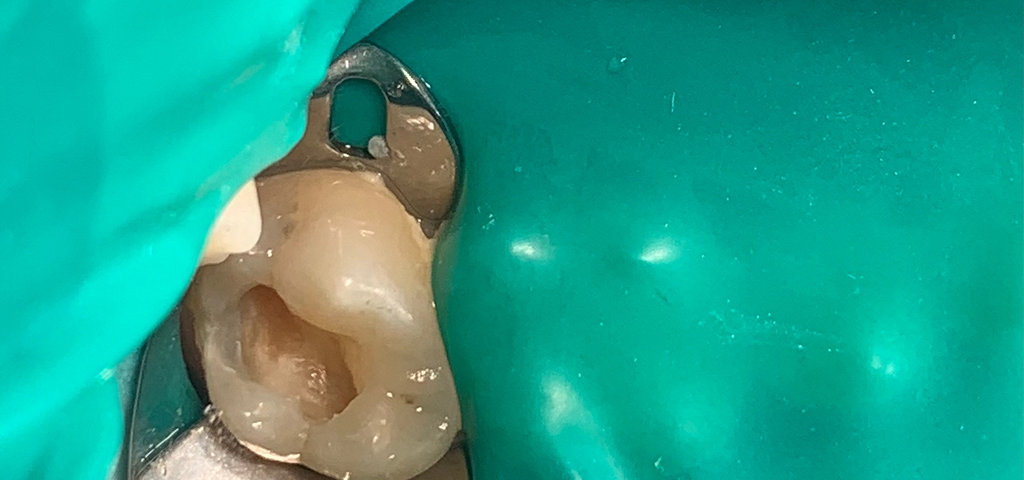 Антистрессовое лечение