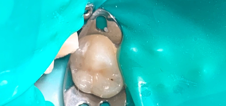 Антистрессовое лечение