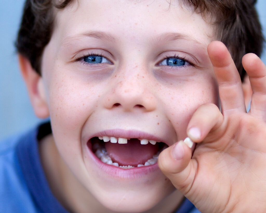 Treatment of dental injuries