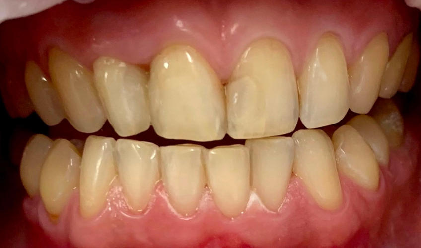 Антистрессовое лечение