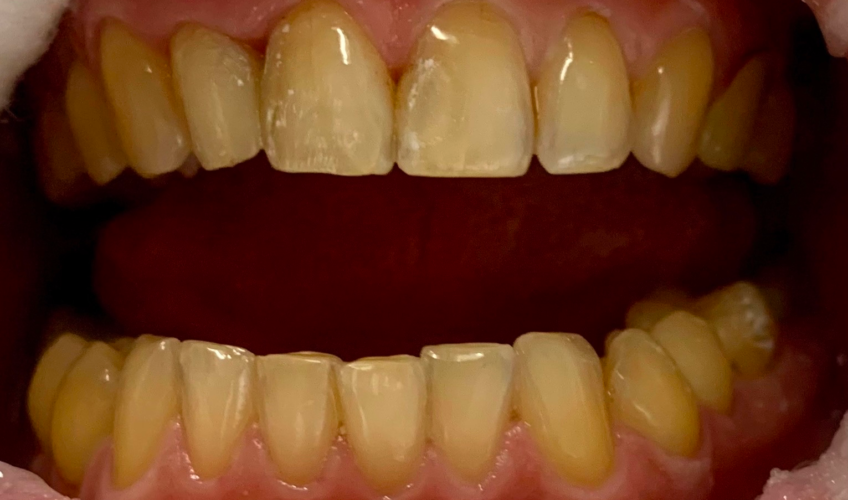 Антистрессовое лечение