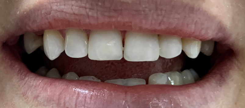 Антистресове лікування