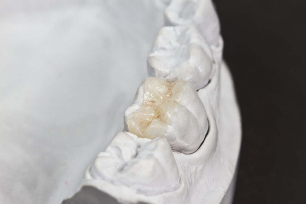 Micro-Prosthetics in Krakow