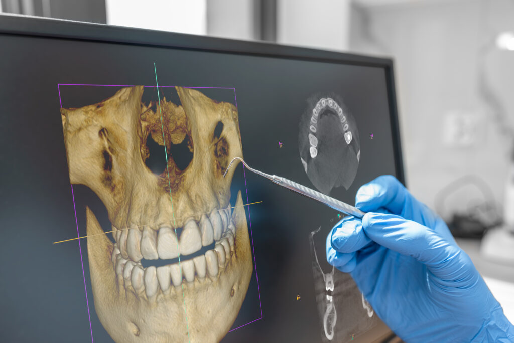 Preventive Dental CheckUps