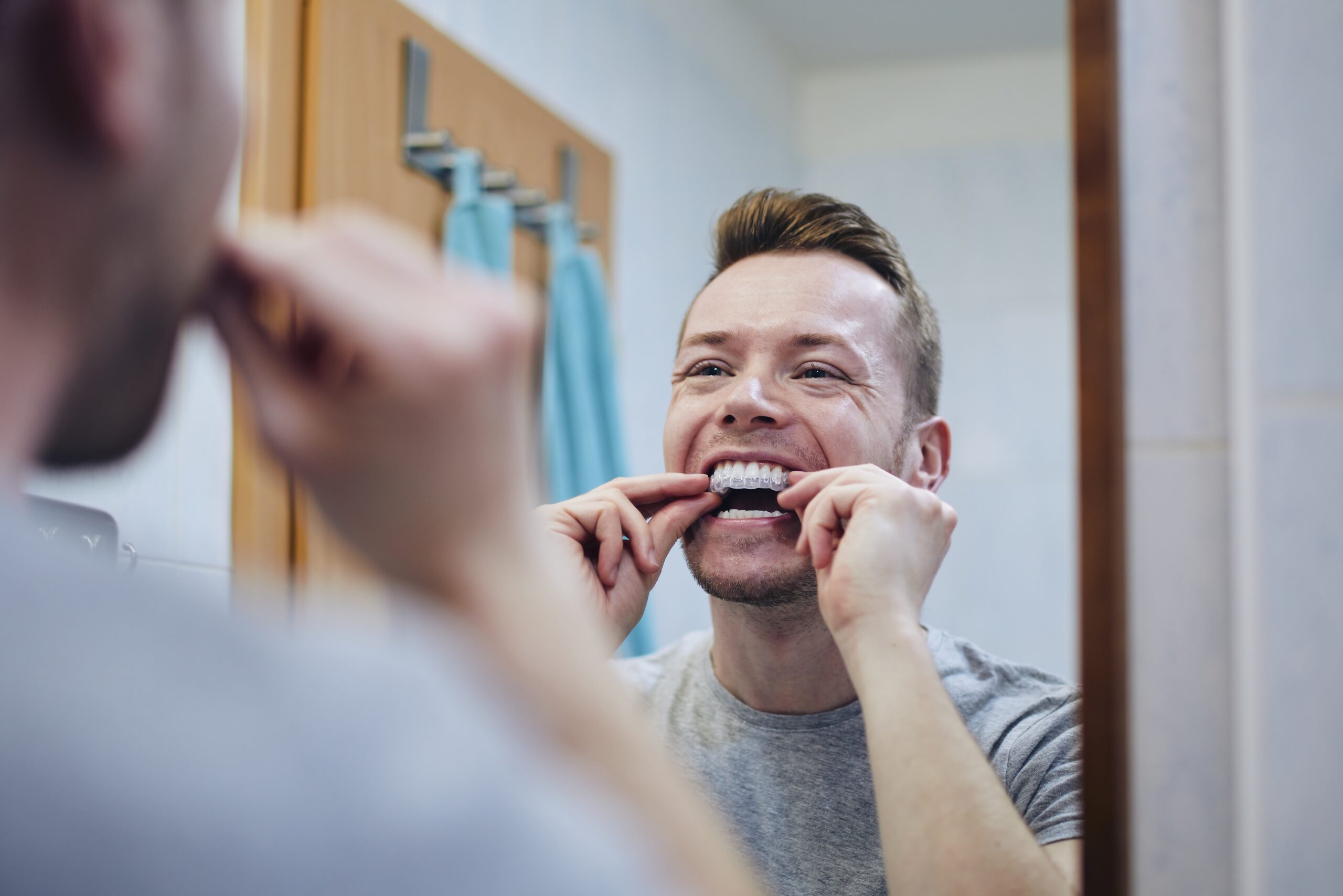 Opalescence teeth whitening