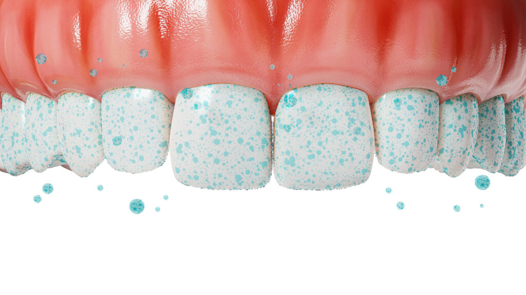 Fluoridation and Remotherapy (Remineralization) of Teeth