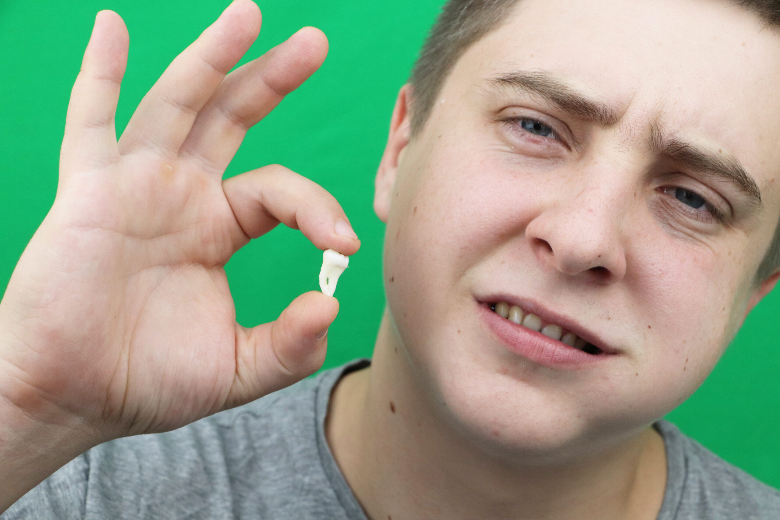 Treatment of a knocked-out tooth 