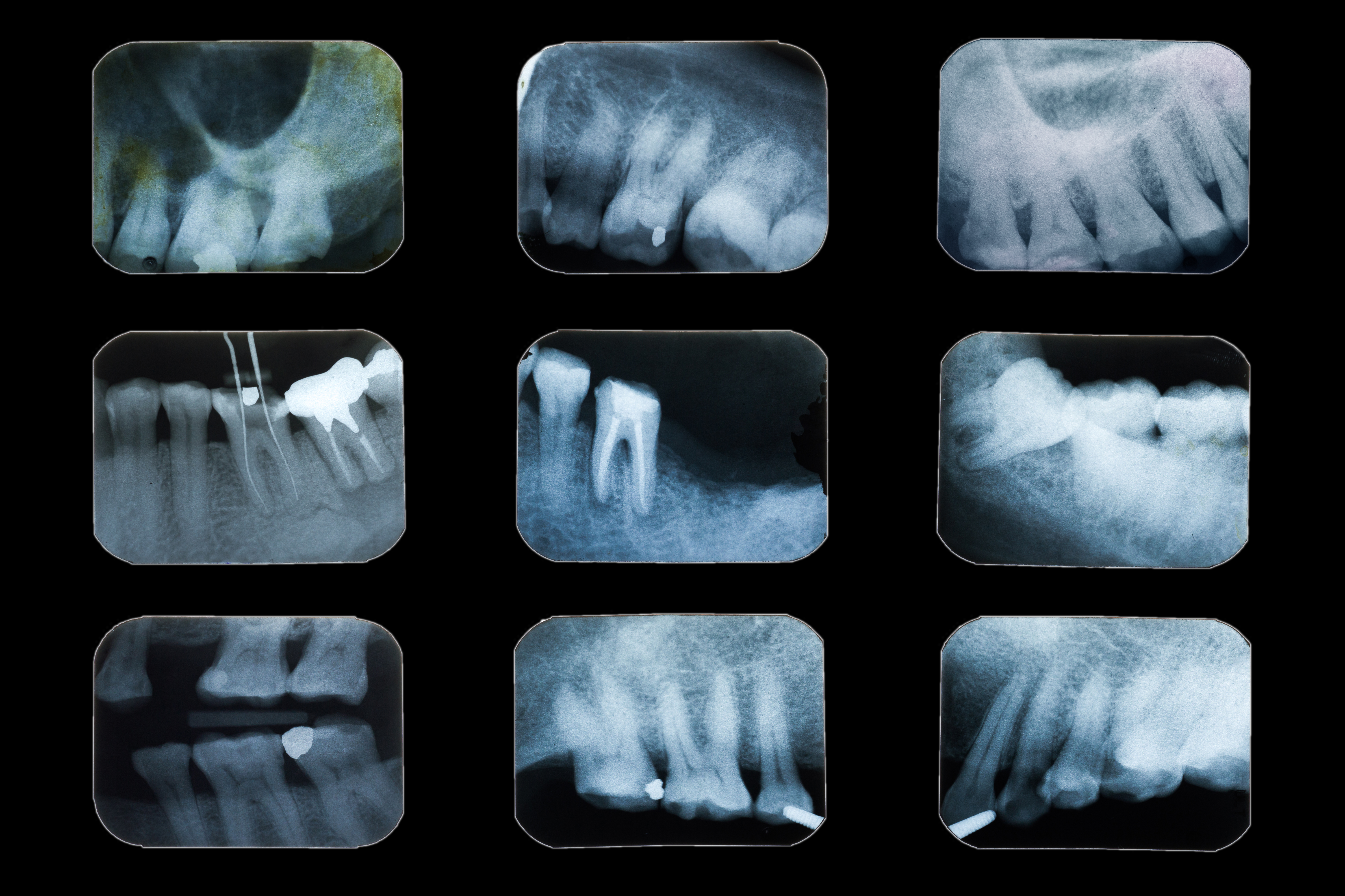 Dental diagnostic