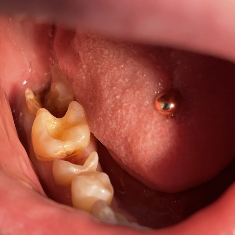 Антистрессовое лечение