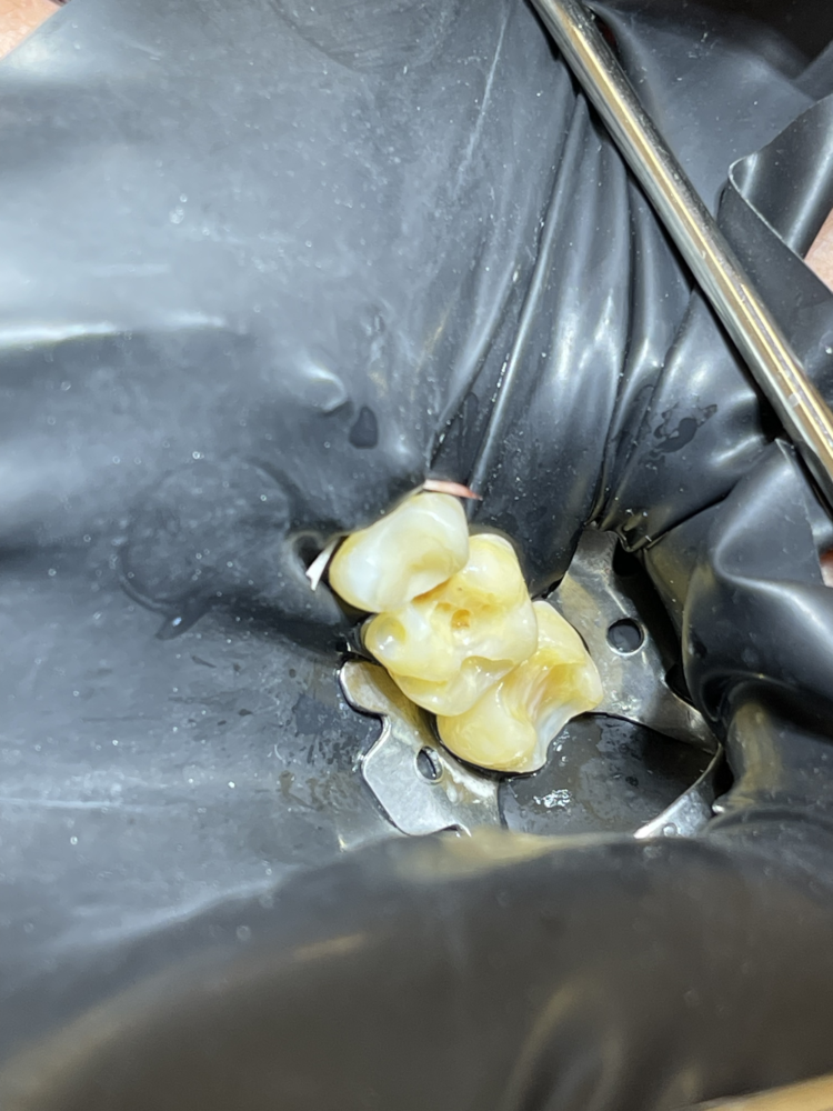 Антистресове лікування