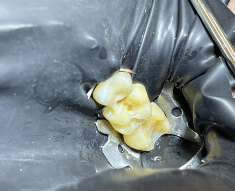 Антистрессовое лечение