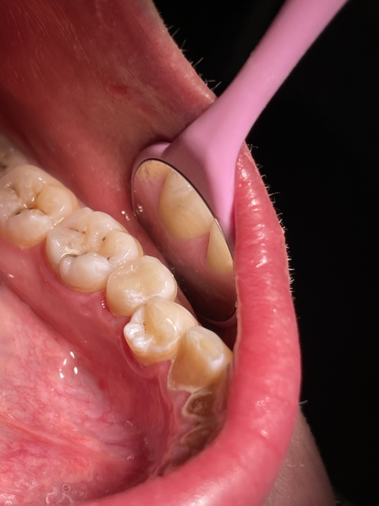 Антистрессовое лечение