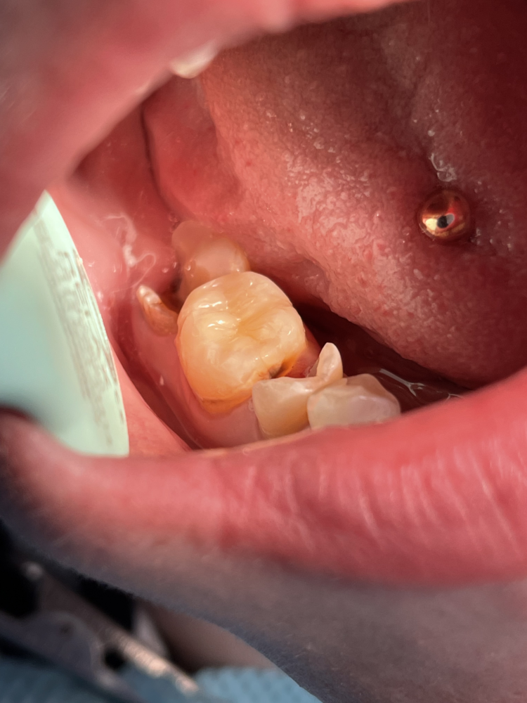 Антистресове лікування