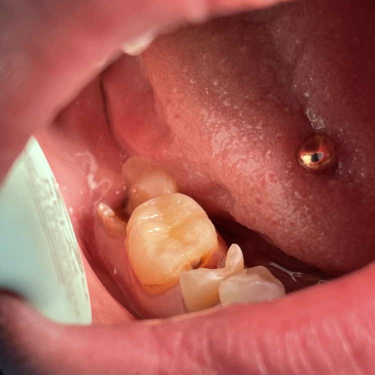 Антистрессовое лечение