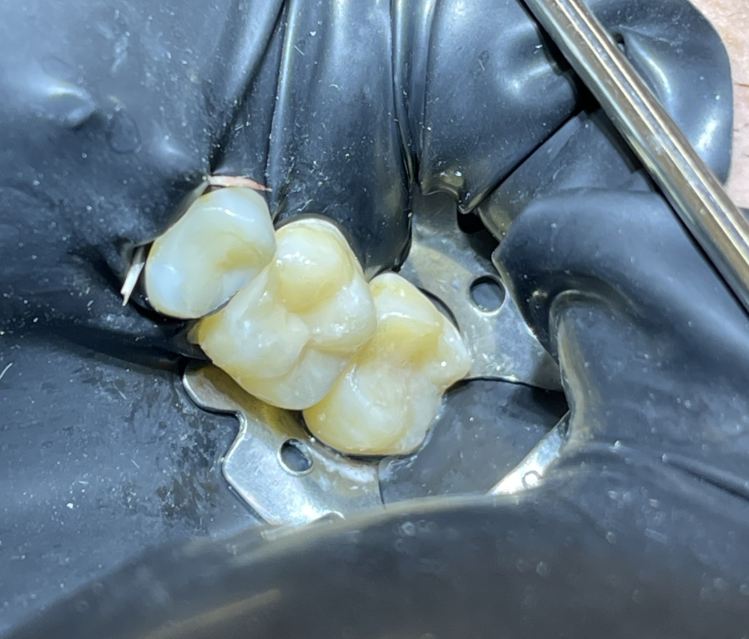 Антистрессовое лечение