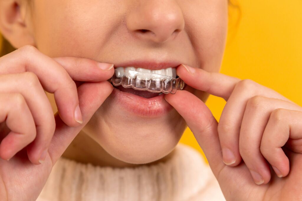 Retainers  