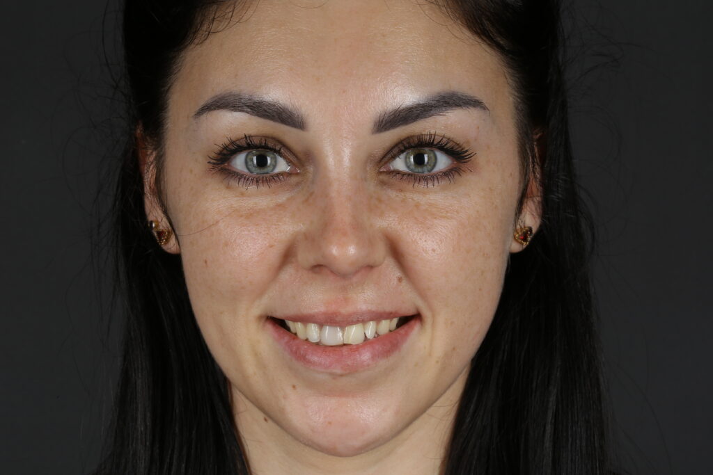 alina potrait before