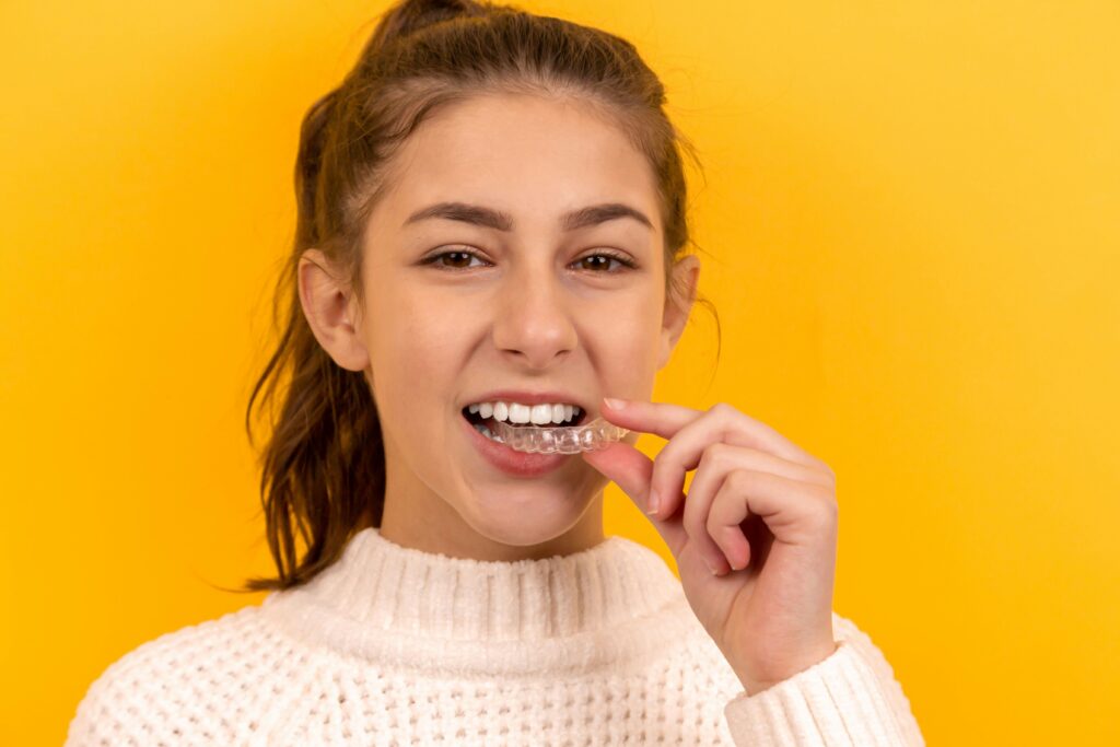Aligners