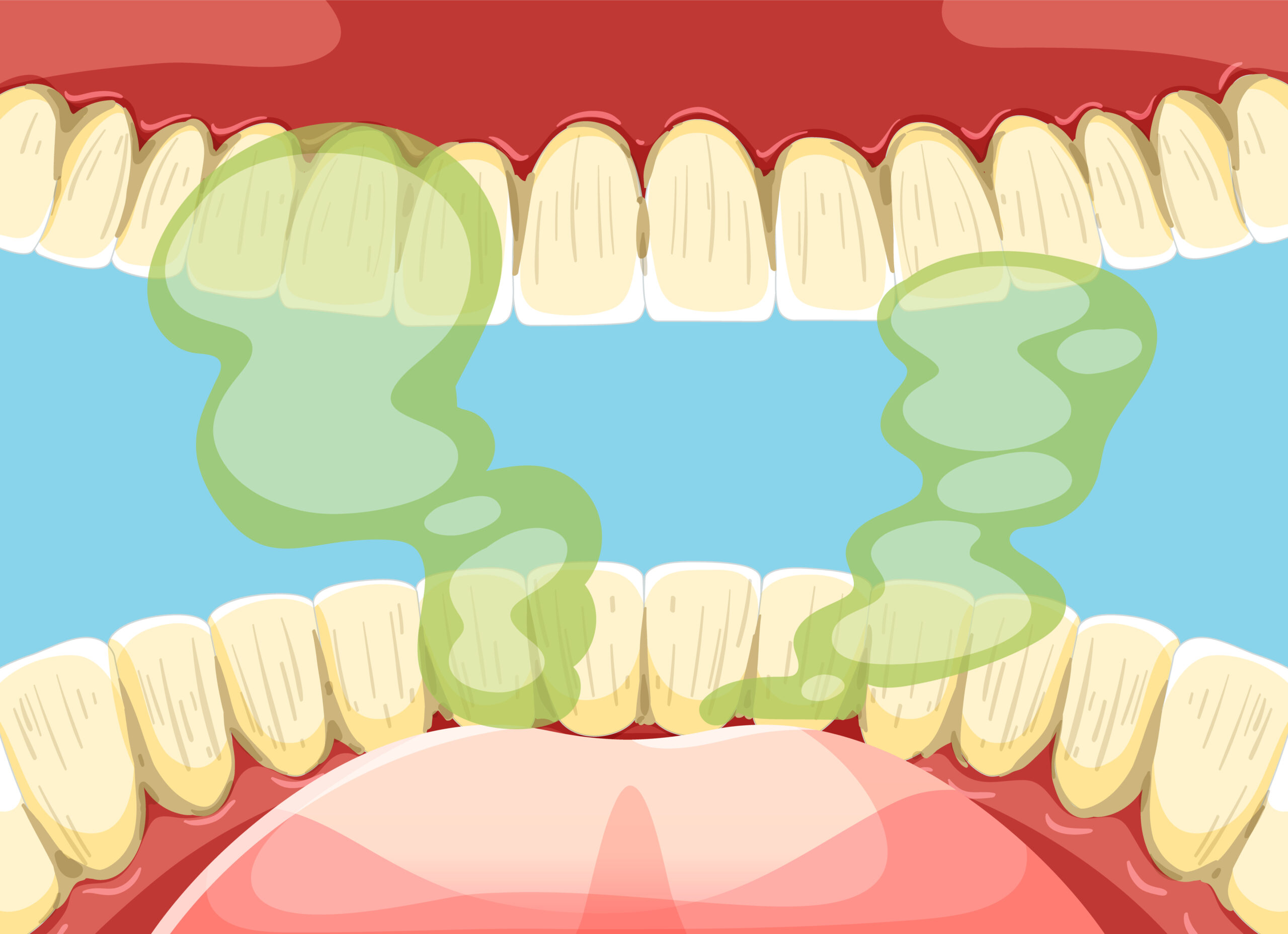 Halitosis treatment in Poland – prices for bad breath treatment at ...