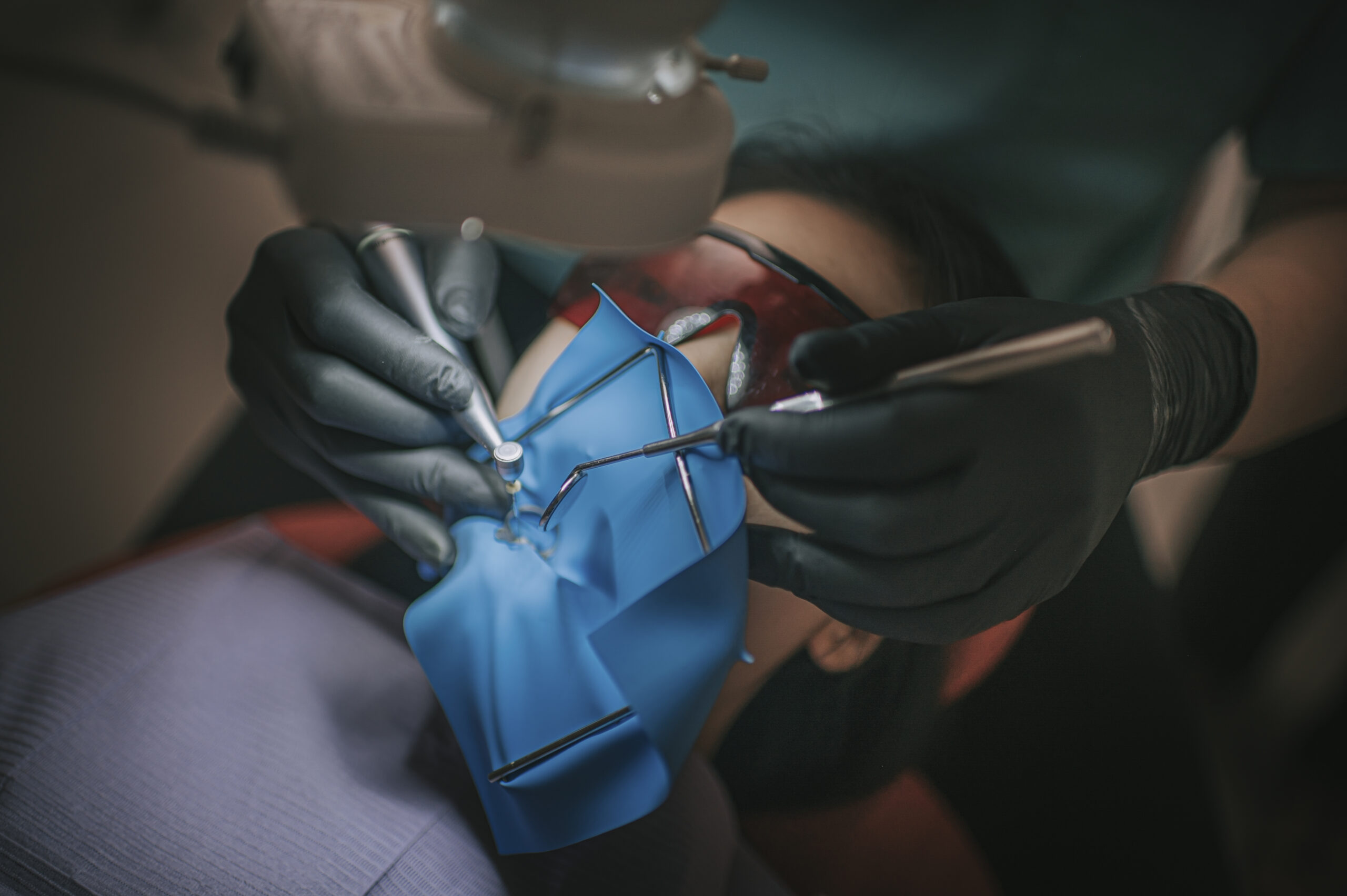Root Canal Under a Microscope in Krakow