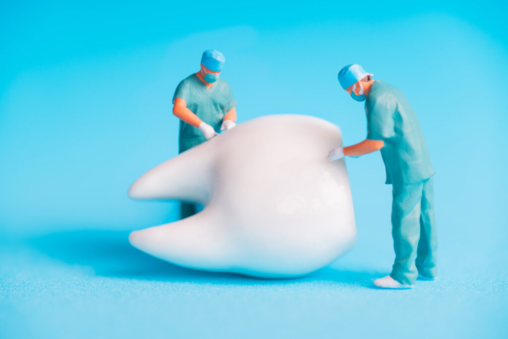 Autotransplantation teeth