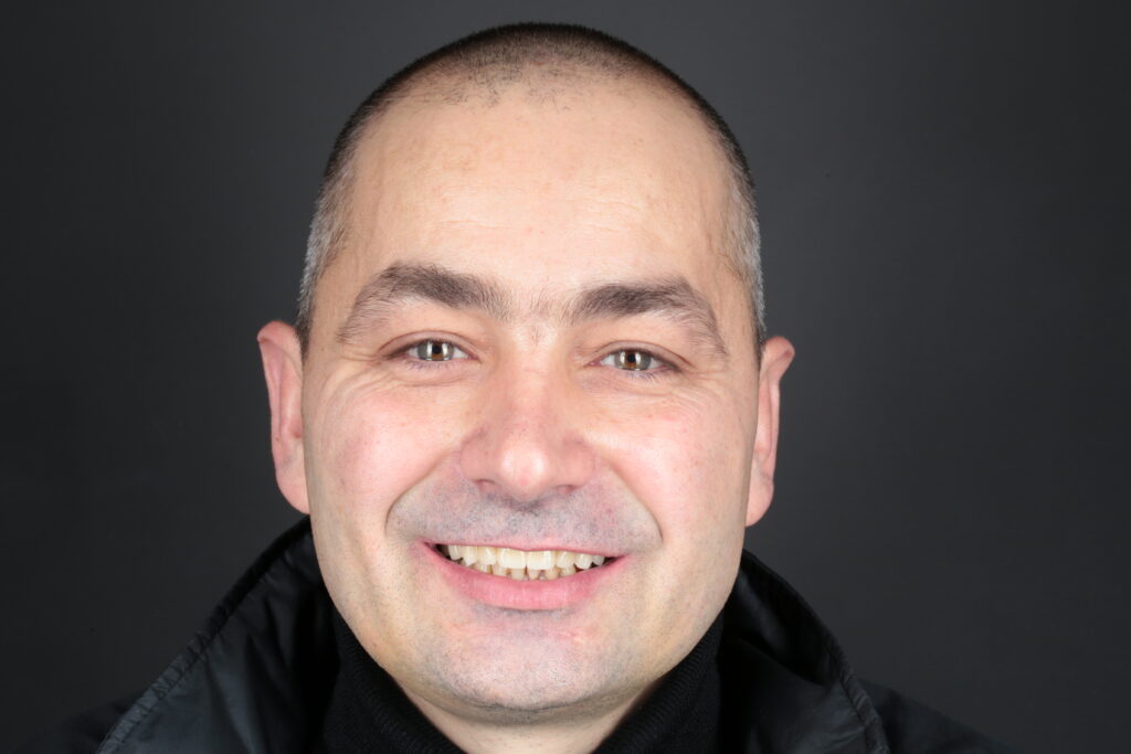 Full dental arch restoration using the All-on-4 protocol with immediate loading