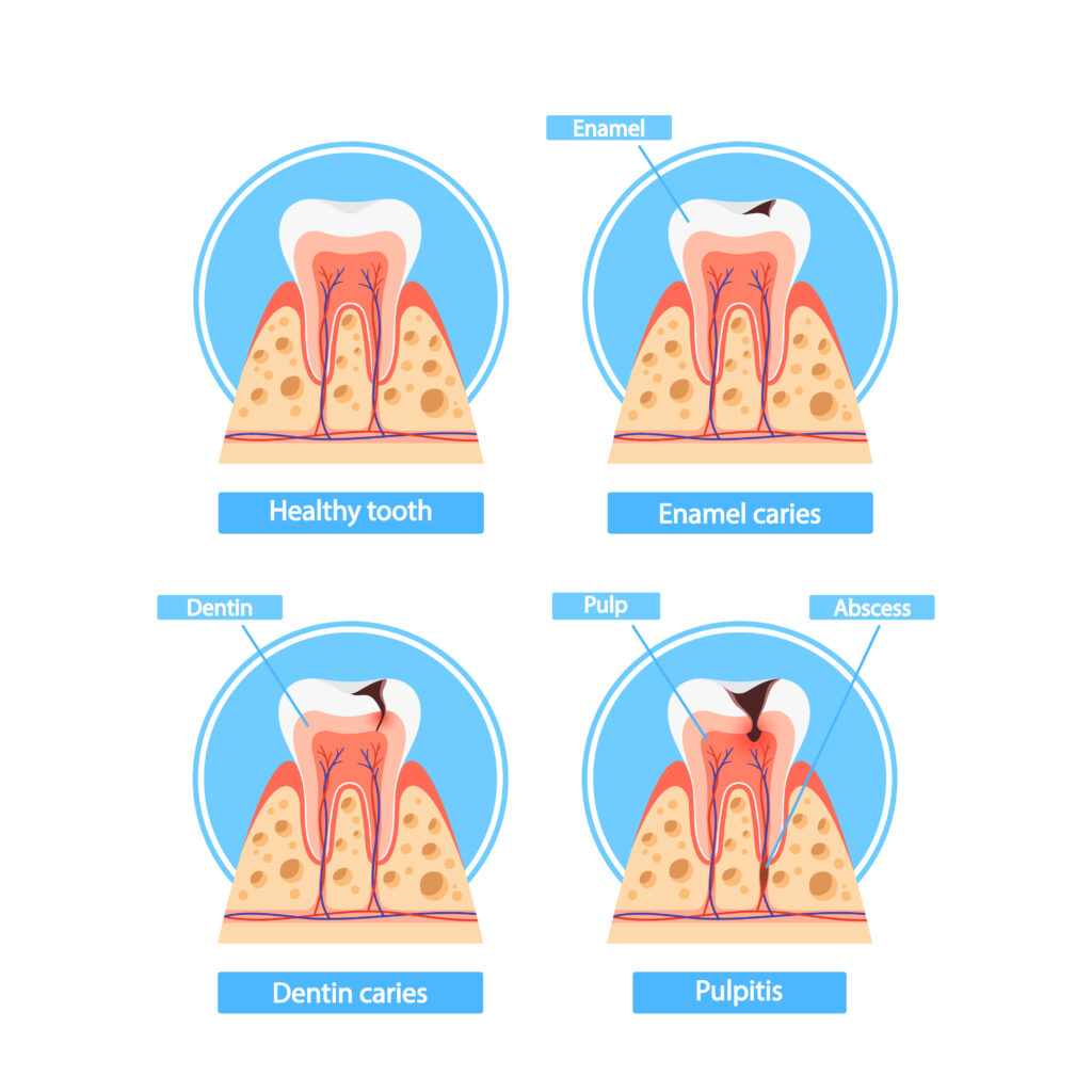 Therapeutic Dentistry