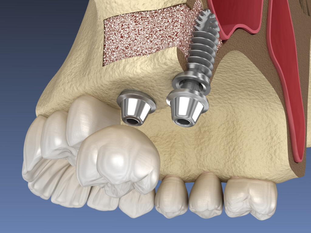 Dental and oral surgery