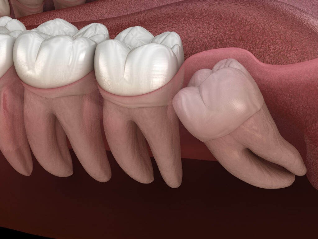 Dental and oral surgery