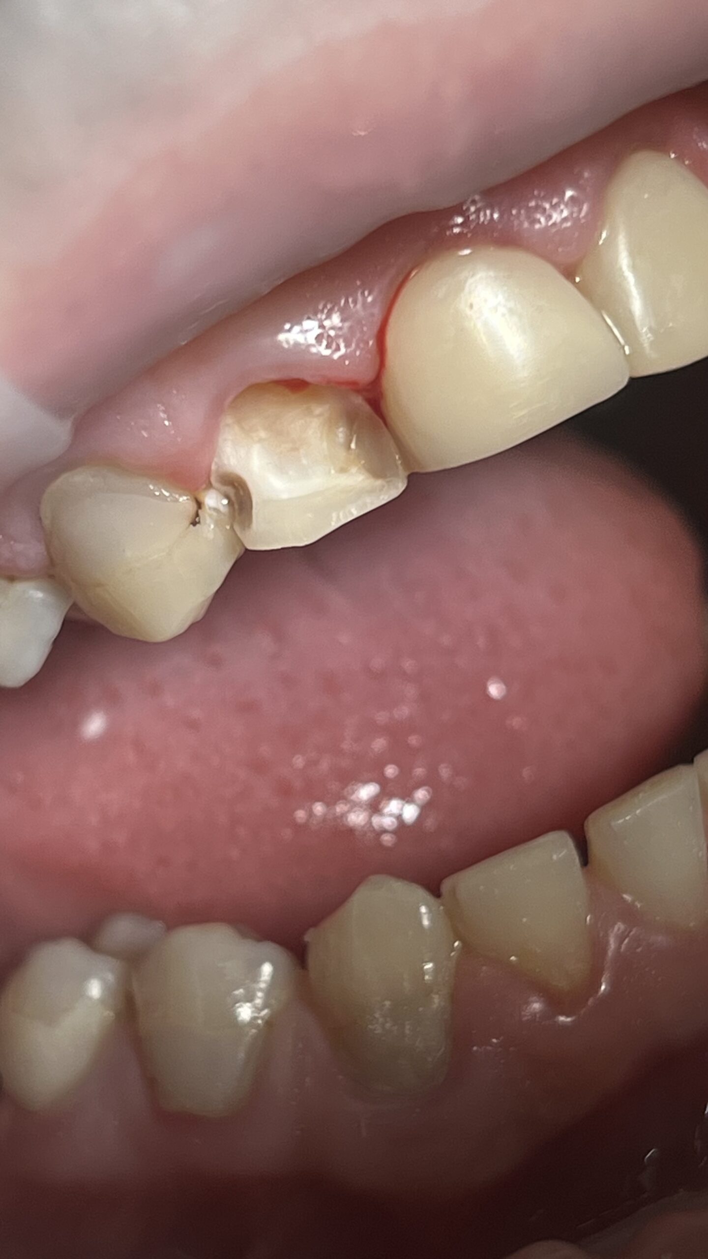 Bezstresowe leczenie