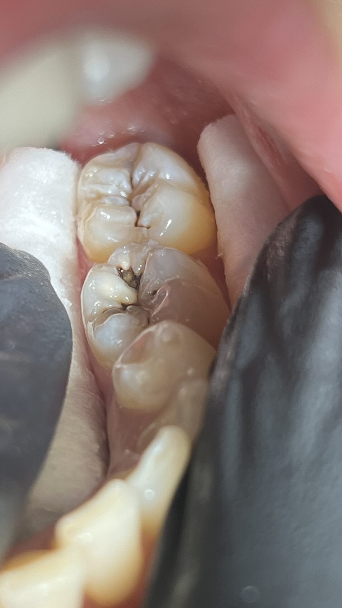 Bezstresowe leczenie