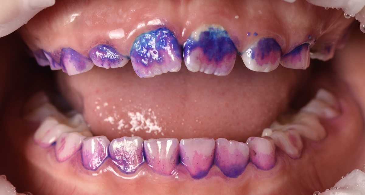 Bezstresowe leczenie