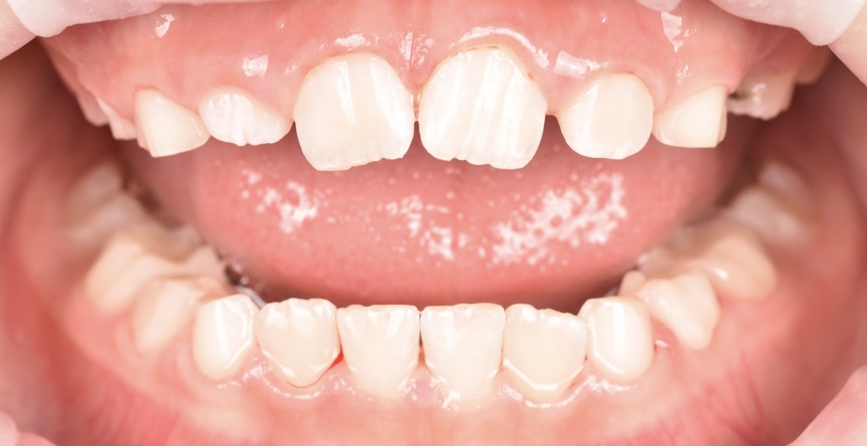 Bezstresowe leczenie