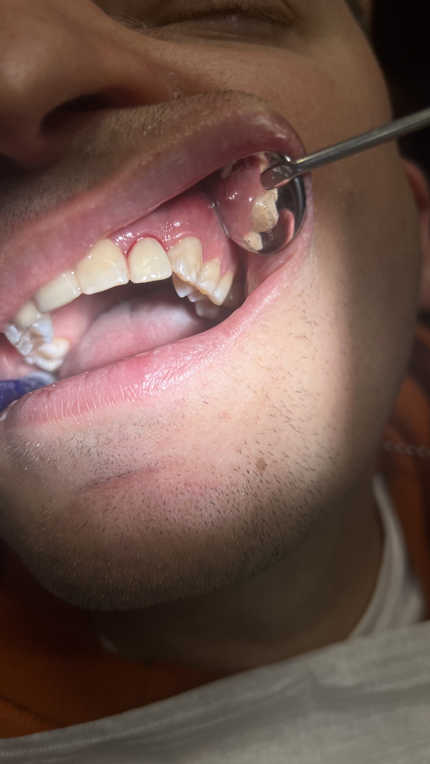 Bezstresowe leczenie