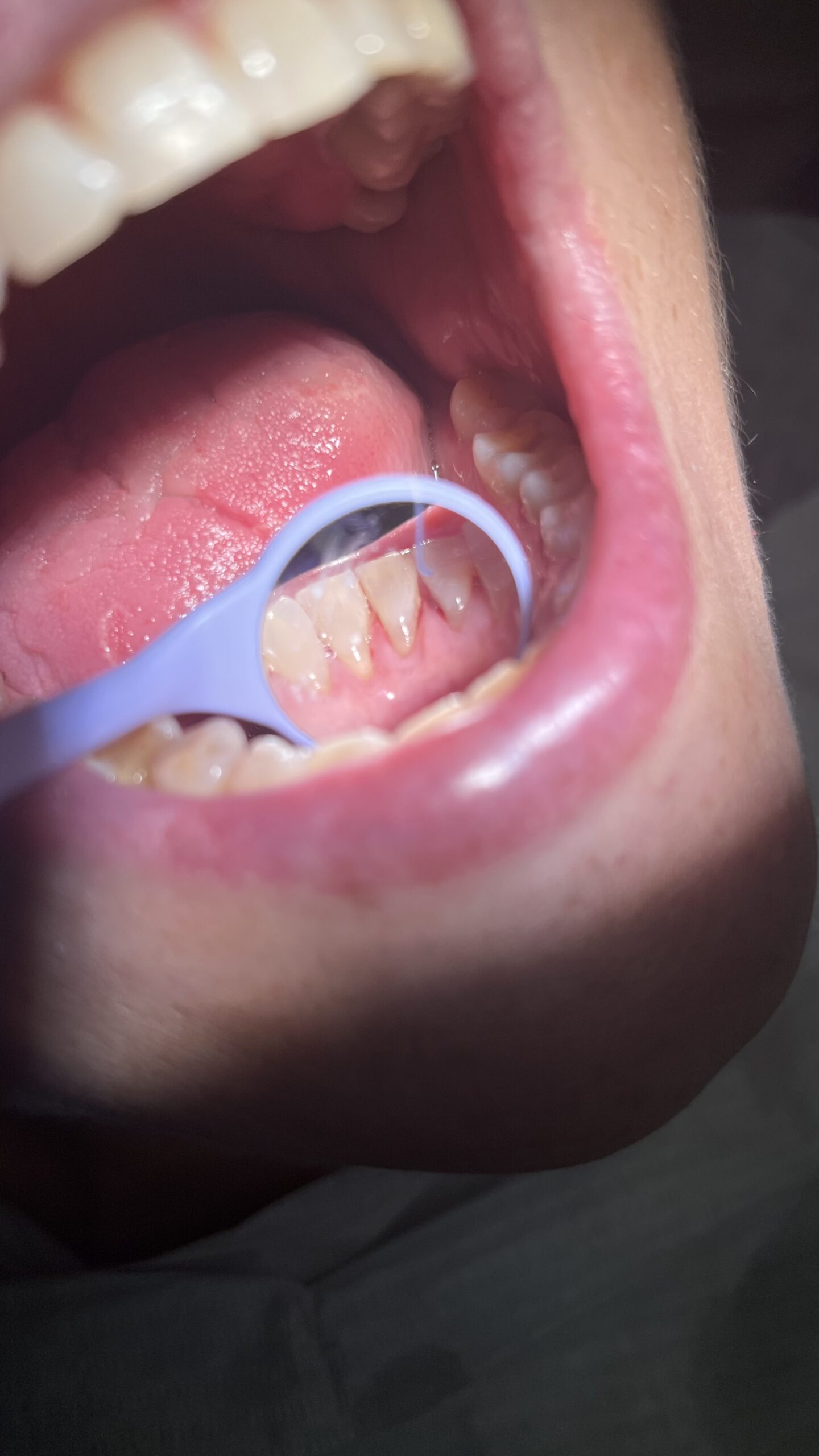 Bezstresowe leczenie