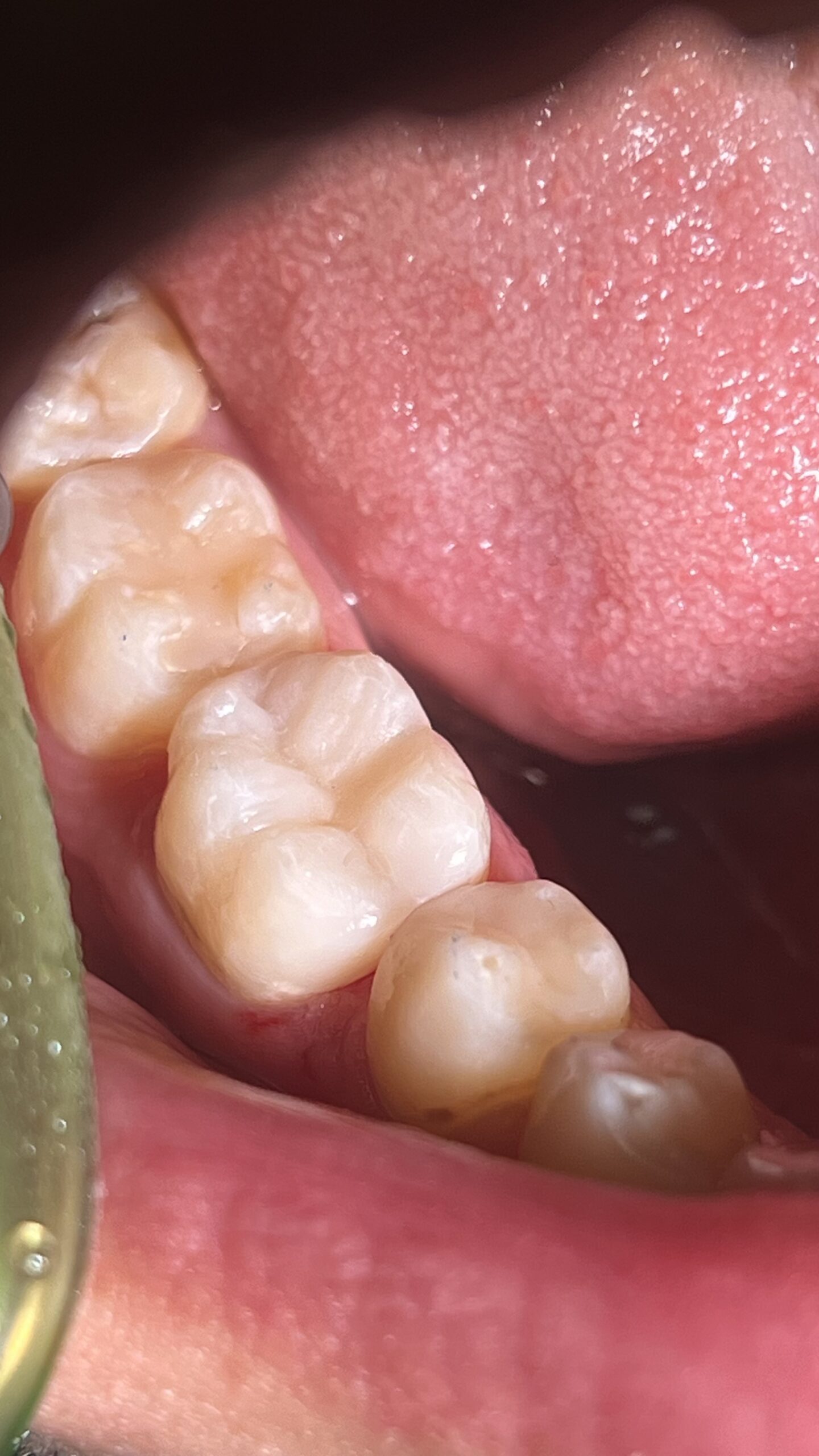 Bezstresowe leczenie