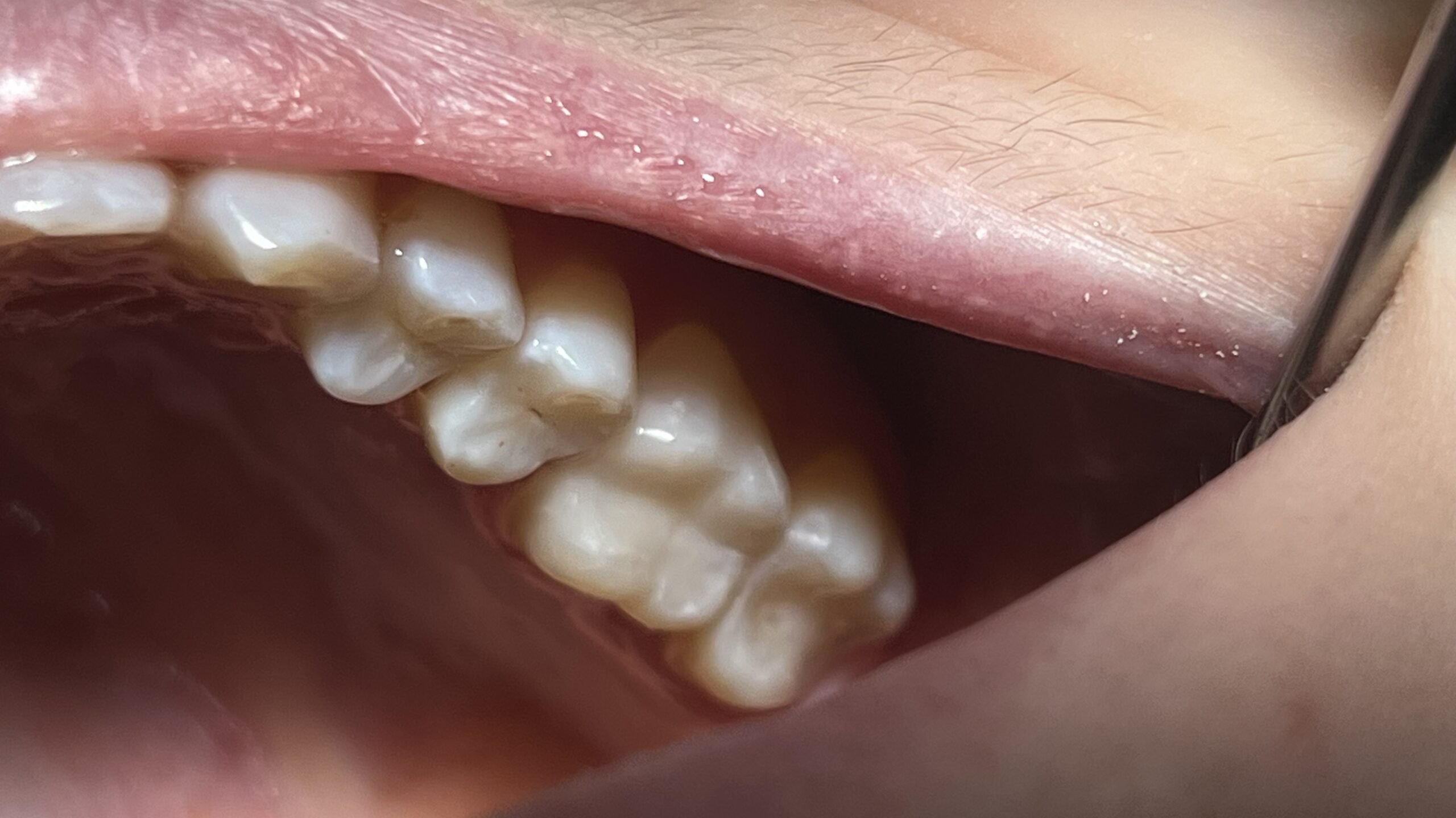 Bezstresowe leczenie