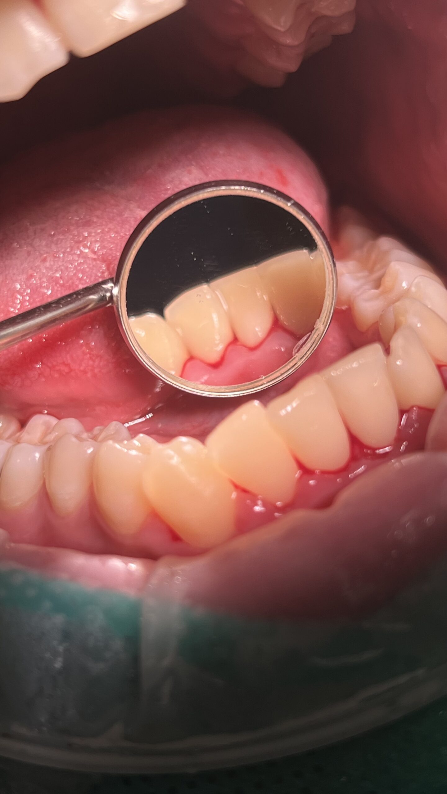 Bezstresowe leczenie