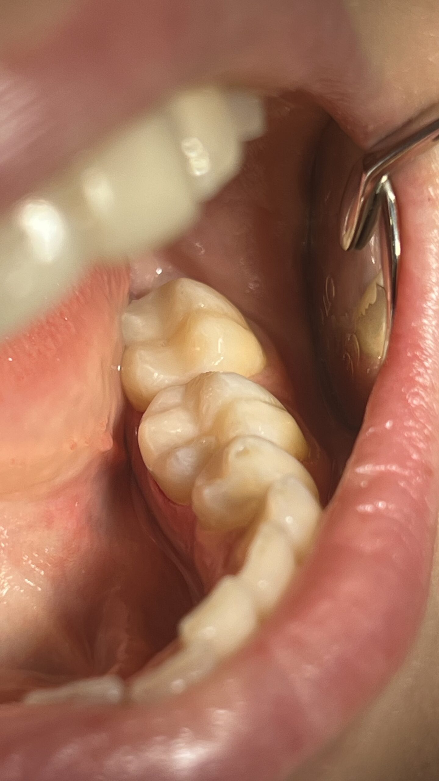 Bezstresowe leczenie