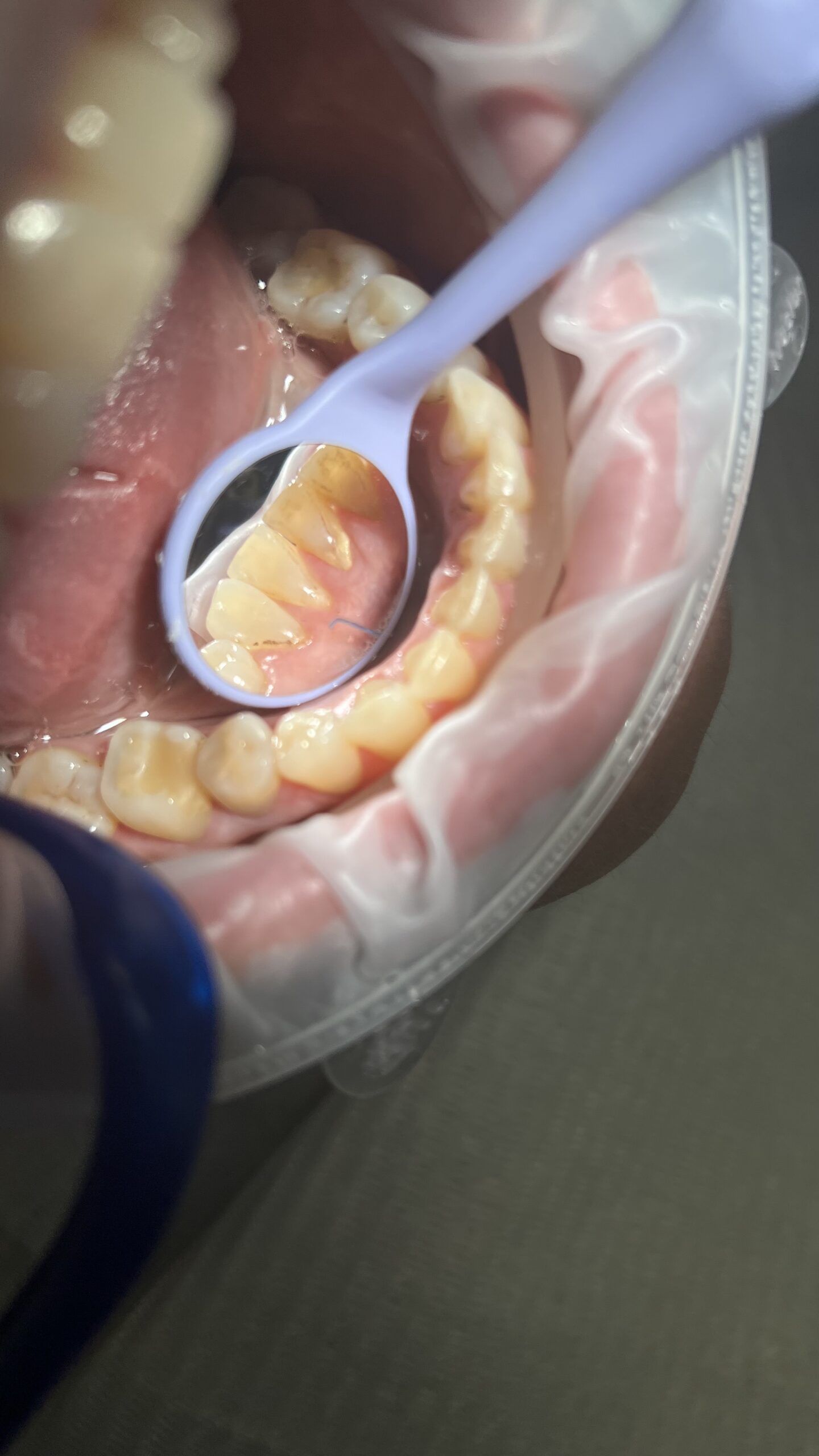 Bezstresowe leczenie