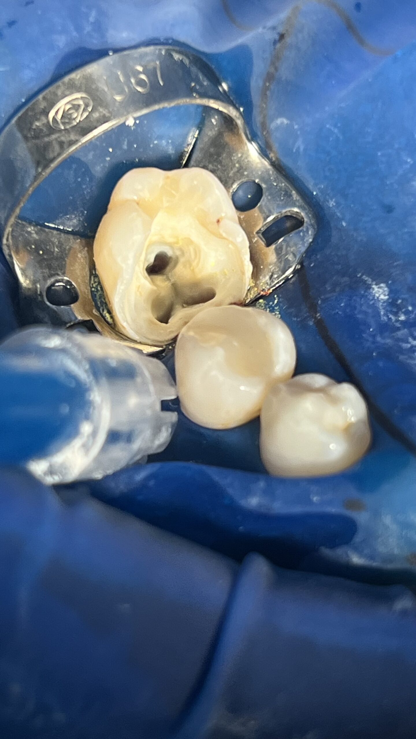 Bezstresowe leczenie