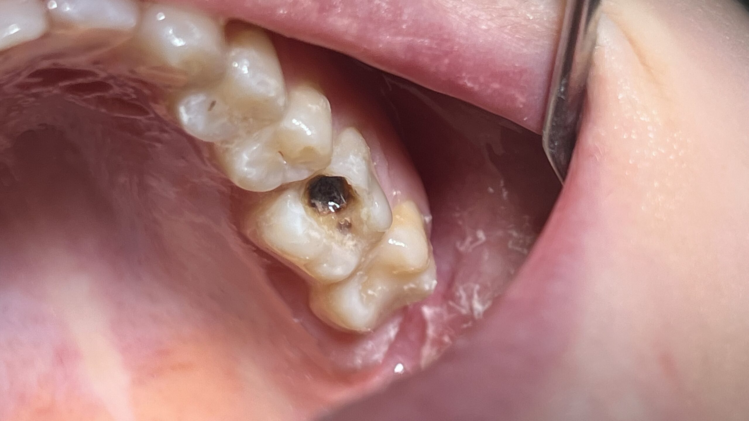 Bezstresowe leczenie