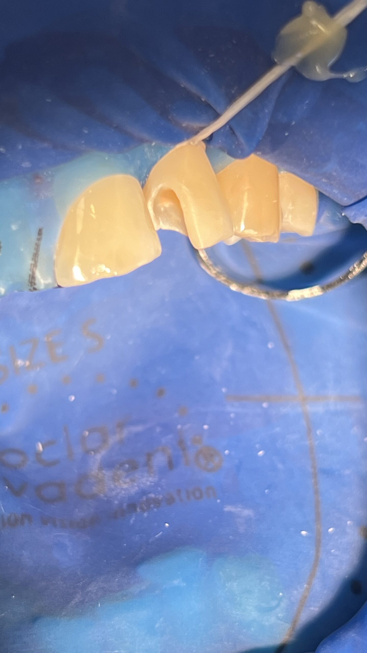 Bezstresowe leczenie