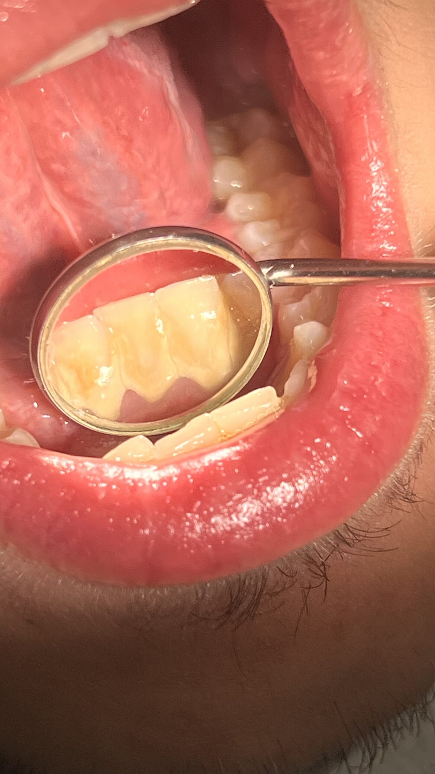 Bezstresowe leczenie