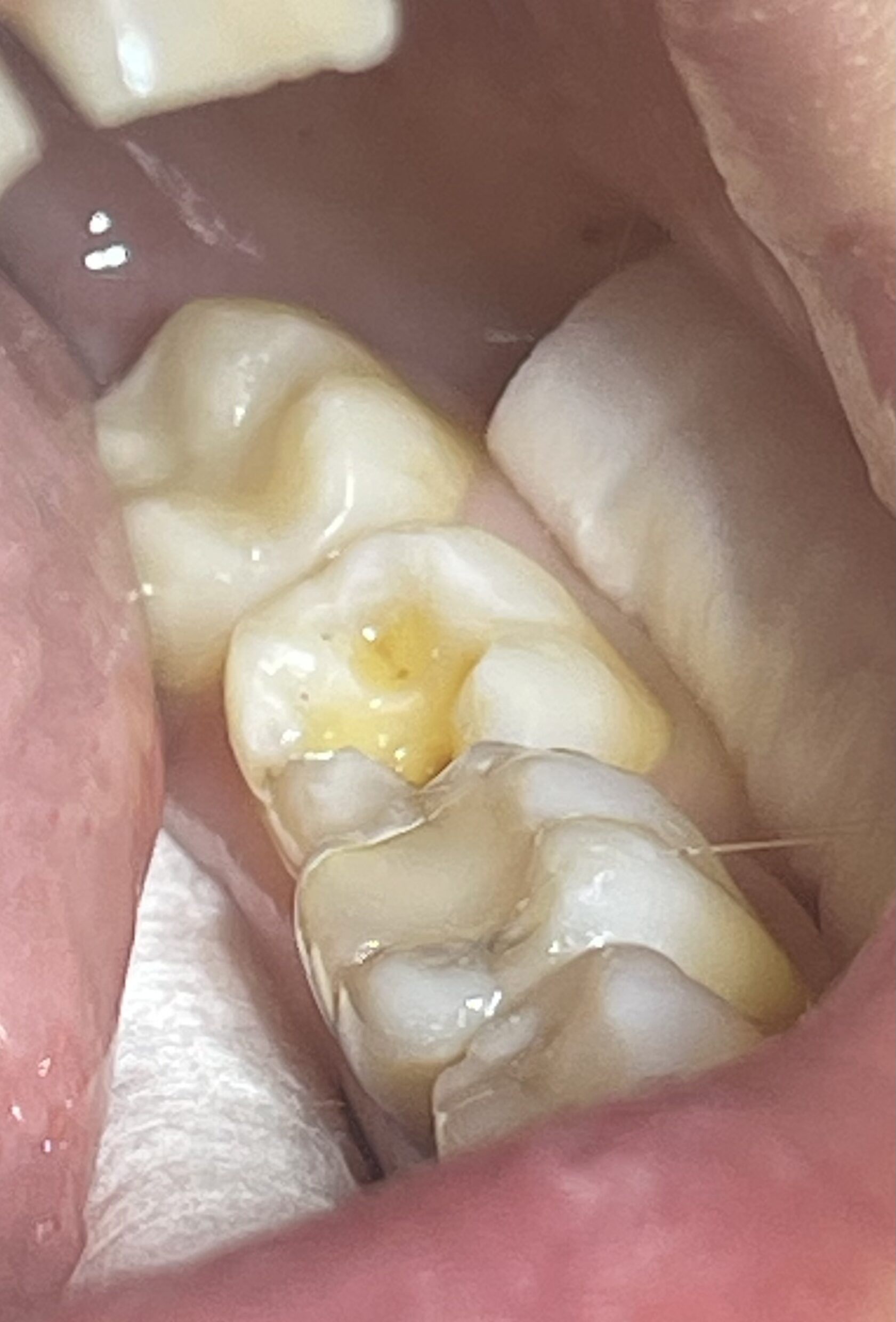 Anti-stress dentistry