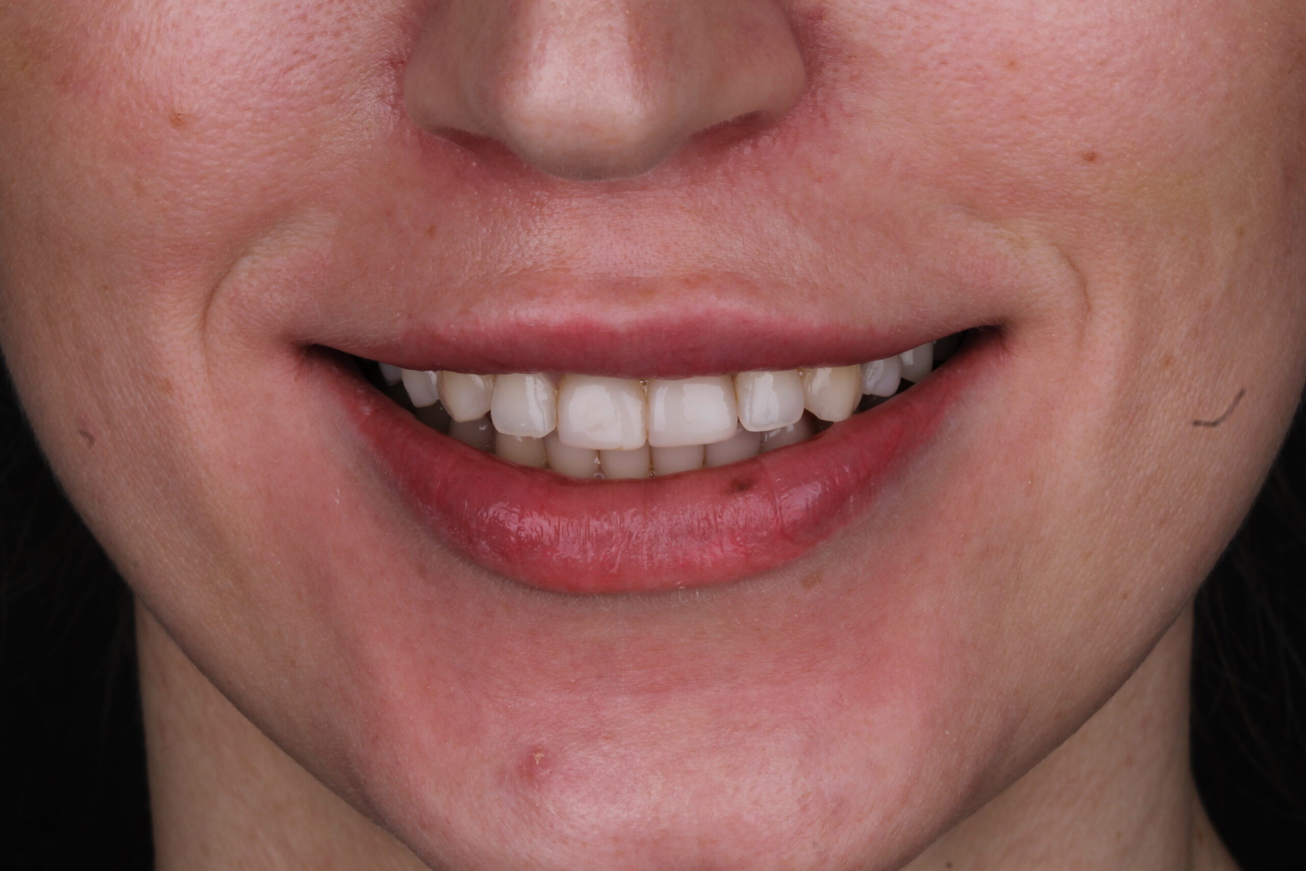 Przed/Po